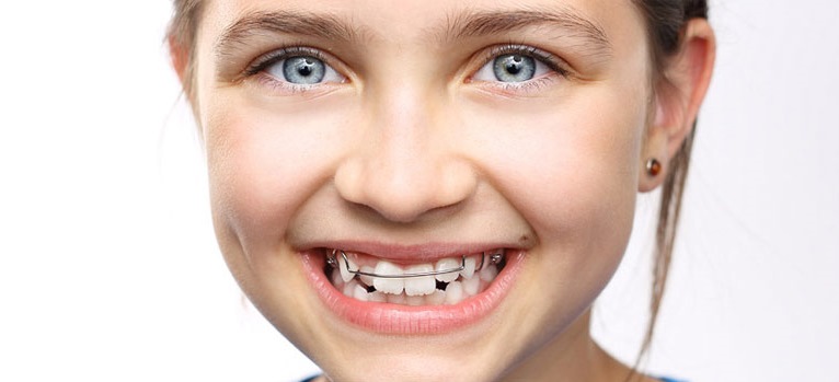 All You Have To Know When Searching For the Best Orthodontist
