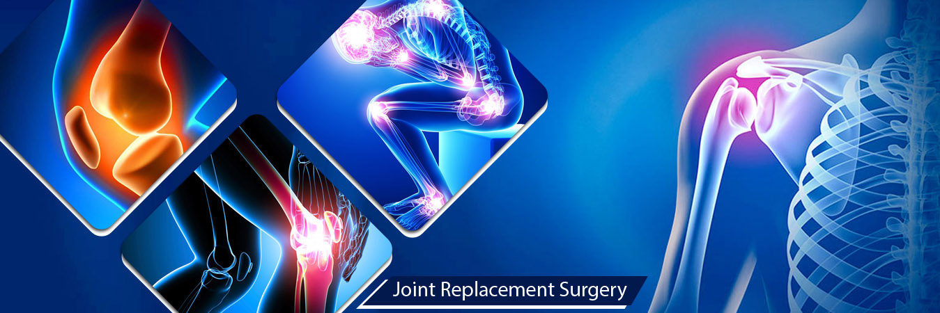 Time Getting Important of Joint Replacement Surgery Doctor in Ahmedabad