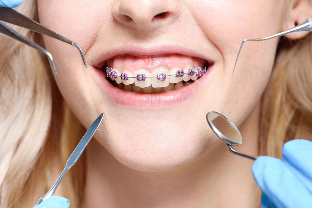 Orthodontists Can Give You The Smile You’ve Always Wanted!