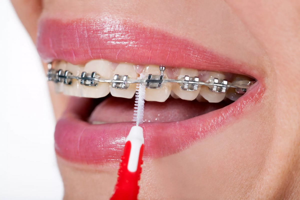 A Comprehensive Guide for Choosing the Right Orthodontist
