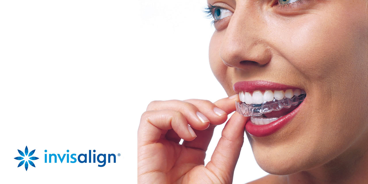 Transparent Orthodontics: Journey to a Beautiful Smile with Invisalign
